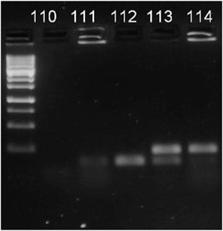 Overlapping exposure effects of pathogen and dimethoate on honeybee (Apis mellifera Linnaeus) metabolic rate and longevity